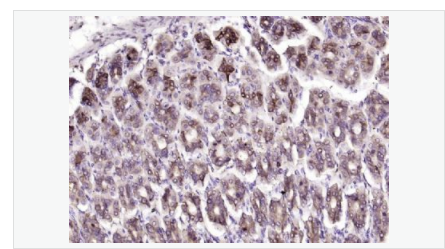 6052a757a1802.png image.png