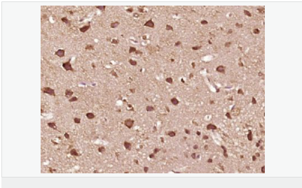 6052bdcf7c8de.png image.png