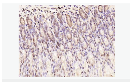 605841d1a0ea8.png image.png