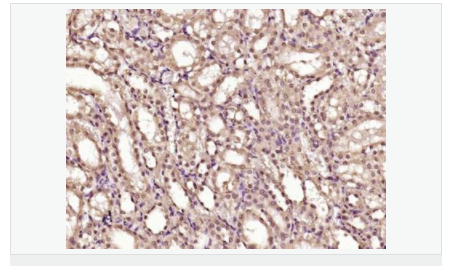 606bcc52ac9de.png image.png