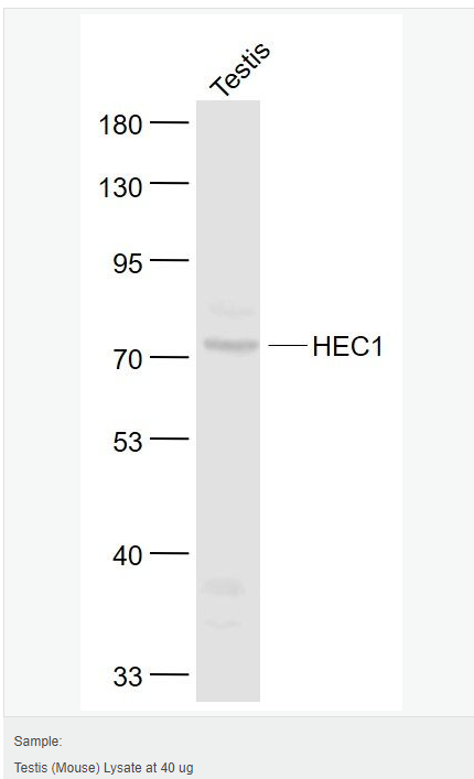 60765b14afcd6.png image.png