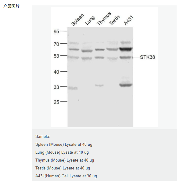 6077e05226117.png image.png